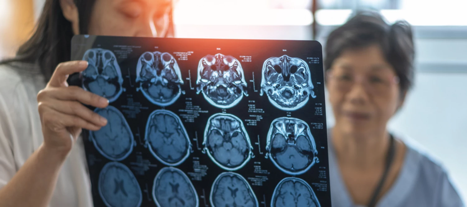 A doctor reviews brain scans with an elderly patient, highlighting diagnostic procedures for Alzheimer's disease.